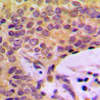 2 - Anti-CCP2 Antibody AP60116