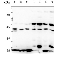 1 - Anti-CDKL4 Antibody AP60129