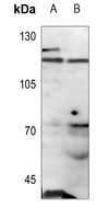 1 - Anti-ANKRD20A1 Antibody AP60141