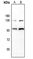 1 - Anti-CD85j Antibody AP60155