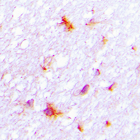 2 - Anti-REG4 Antibody AP60204