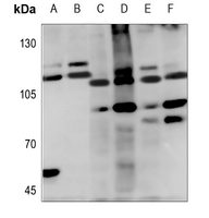 1 - Anti-Cadherin 19 Antibody AP60244