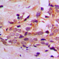 2 - Anti-DYNLL2 Antibody AP60270