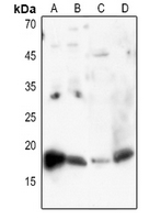 1 - Anti-Histone H3 (AcK27) Antibody AP60313