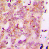 2 - Anti-HLA-H Antibody AP60317