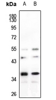 1 - Anti-hnRNP A2/B1 Antibody AP60318
