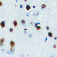 2 - Anti-LYL1 Antibody AP60335