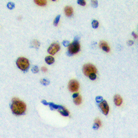 2 - Anti-RFWD3 Antibody AP60383