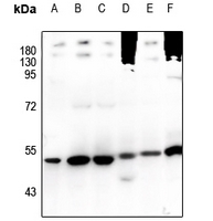 1 - Anti-TRIM38 Antibody AP60412