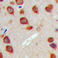 2 - Anti-WASF3 Antibody AP60418