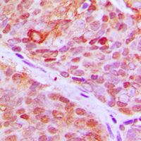 2 - Anti-ZNF148 Antibody AP60420