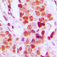 2 - Anti-DDX52 Antibody AP60450
