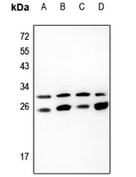 1 - Anti-EIF3K Antibody AP60454