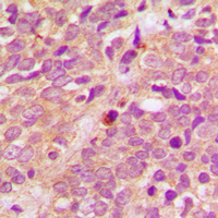 2 - Anti-PRKD1/2/3 (Phospho-S738/S742) Antibody AP60476