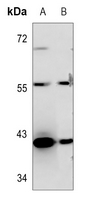 1 - Anti-OBCAM Antibody AP60494