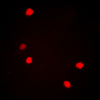 3 - Anti-c-Jun (Phospho-S73/100) Antibody AP60578