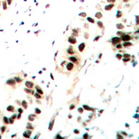 2 - Anti-c-Jun (Phospho-S73/100) Antibody AP60578