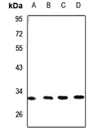 1 - Anti-DHRS4 Antibody AP60665