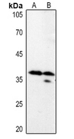 1 - Anti-LASP1 Antibody AP60680