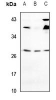 1 - Anti-VTI1A Antibody AP60692