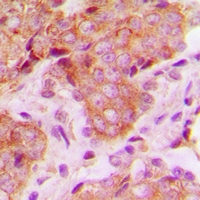 2 - Anti-MRPS22 Antibody AP60707