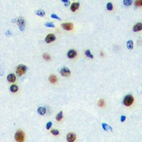 2 - Anti-ZNF785 Antibody AP60727