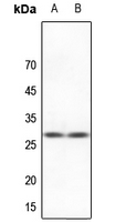 1 - Anti-HSPB2 Antibody AP60745