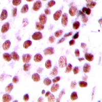 2 - Anti-DIDO1 Antibody AP60746