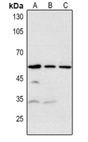 1 - Anti-RRP8 Antibody AP60756