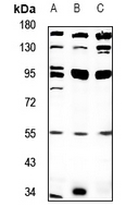 1 - Anti-PPP4R2 Antibody AP60779
