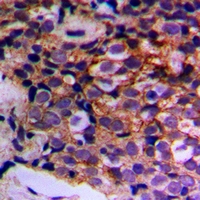 2 - Anti-MTIF3 Antibody AP60786