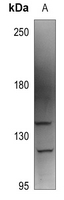 1 - Anti-AAK1 Antibody AP60850