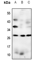 1 - Anti-Claudin 17 Antibody AP60857