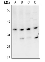 1 - Anti-VPS26B Antibody AP60912