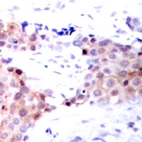 2 - Anti-NACA1 (Phospho-S43) Antibody AP60934