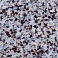 2 - Anti-MSX2 Antibody AP60964