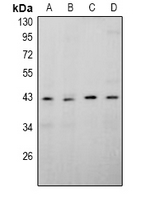 1 - Anti-APOBEC4 Antibody AP60984