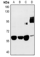 1 - Anti-SRPK3 Antibody AP60999