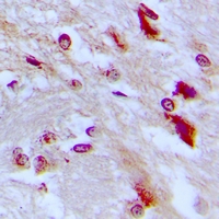 2 - Anti-C/EBP epsilon (Phospho-T74) Antibody AP61071