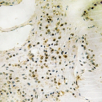 2 - Anti-FOXO1/3 (pS322+S325/pS318+S321) Antibody AP61140