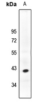 1 - Anti-PHLDA1 Antibody AP61203