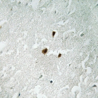 2 - Anti-RRN3 (Phospho-S649) Antibody AP61275