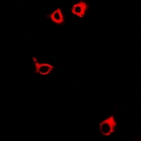 3 - Anti-GPR106 Antibody AP61358