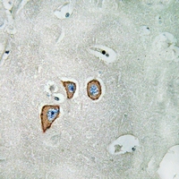 2 - Anti-NMDAR2C Antibody AP61362