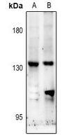 1 - Anti-NMDAR2C Antibody AP61362