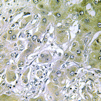 19 - Anti-ACOT12 Antibody AP61468