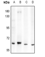 1 - Anti-ACOT12 Antibody AP61468