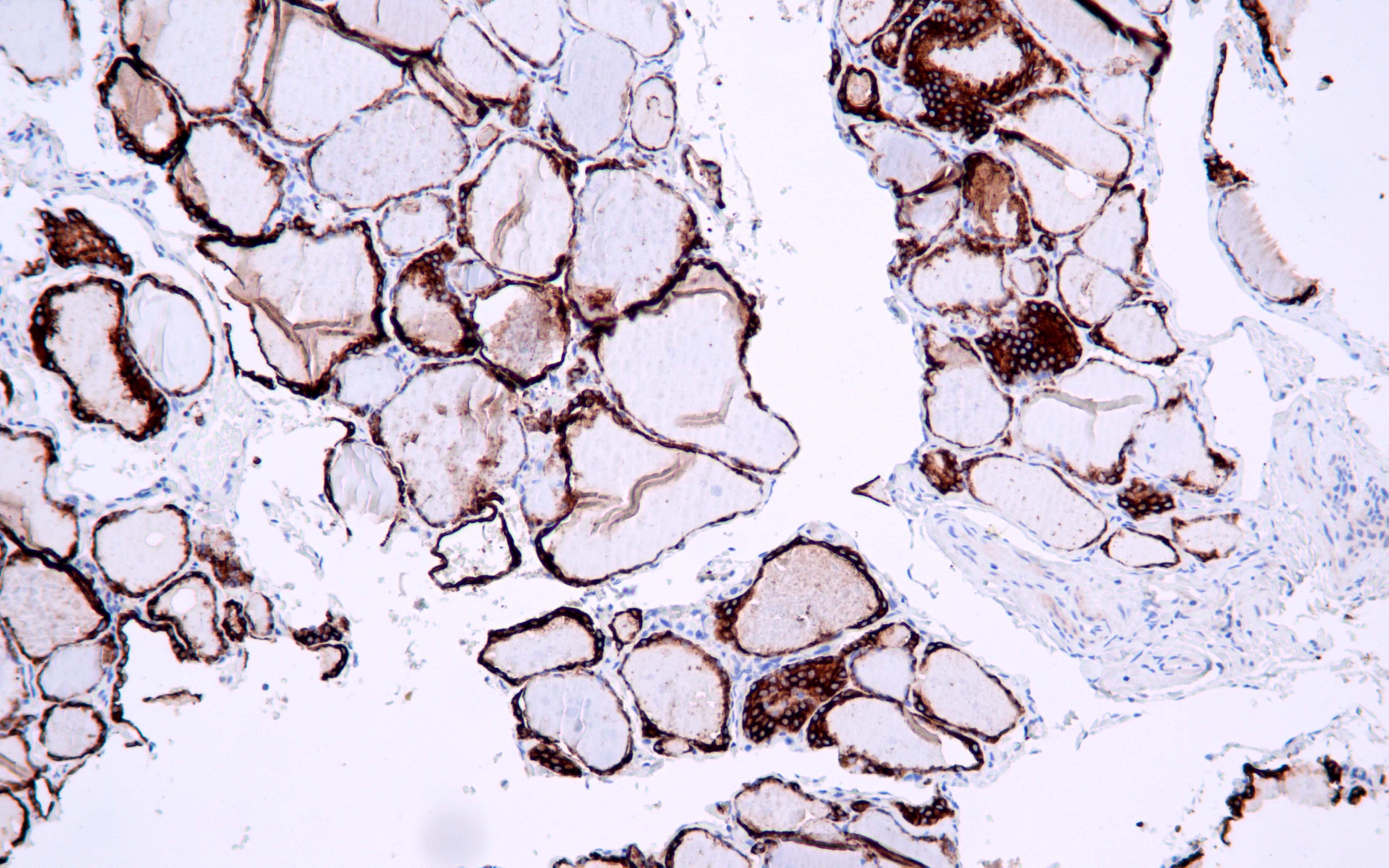TPO Antibody Mouse Monoclonal Antibody (Mab) IHC Buy Now!