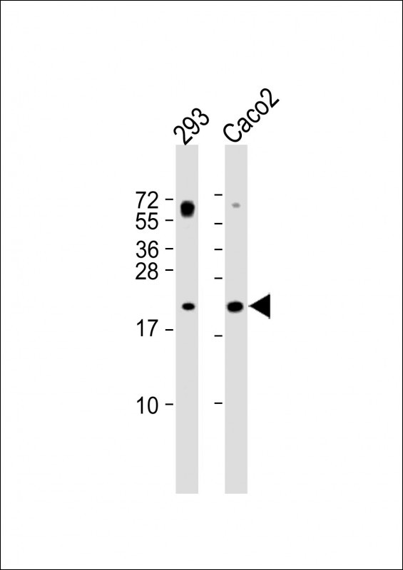 1 - RAC2 Antibody (C-term) AP21363b