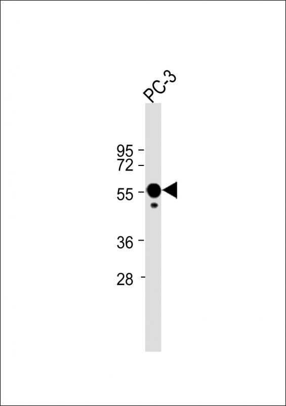 1 - CALR Antibody (Center) AP6898C